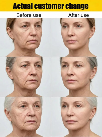 [10-Year Rejuvenation] 🔥Dermaclearo® Collagen Fullerene Cell Regeneration Cream🔥